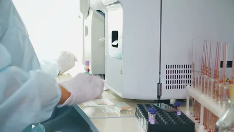 The health worker taps pathology Stock Footage 92123188