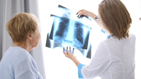 Healthcare, Medical Concept. Doctor Showing Xray To An Elderly Patient. Stock Footage