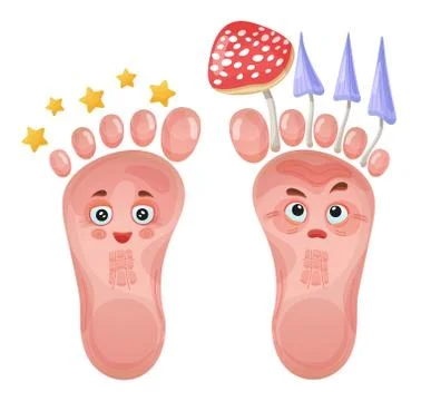 Healthy and problem foot characters. Skin fungus. Pair funny human leg. Vector Ilustración de archivo