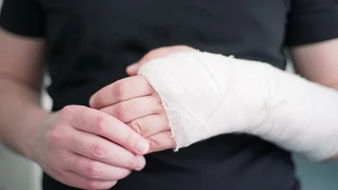 A healthy hand of a young man does a massage of a broken arm in gypsum. Recovery Stock Footage 132996205