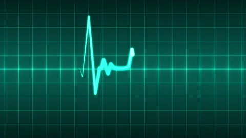 Heartbeat Animation Stock Footage ~ Royalty Free Stock Videos | Pond5