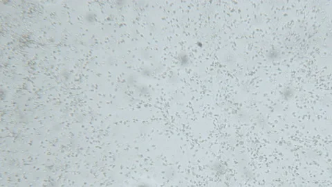 Healthy human sperm under the microscope, spermatozoa, 10x magnification Stock Footage 140503456
