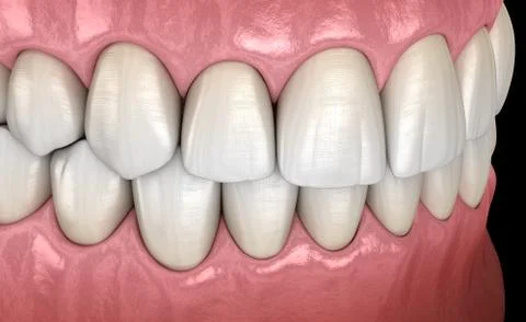 Healthy human teeth with normal occlusion, side view. Medically accurate toot Illustrazione stock