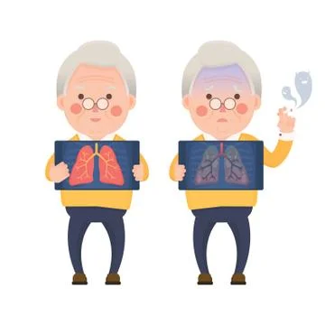 Healthy Lung, Problem Lung Stock Illustration