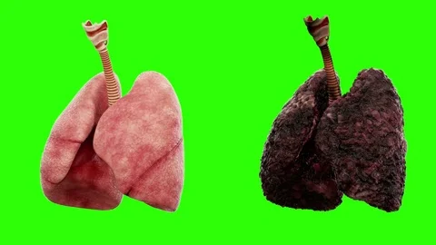 healthy lungs and disease lungs on green... | Stock Video | Pond5