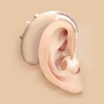 Hearing aid behind the ear. Ear and sound amplifier. Deafness and hearing loss Stock Illustration