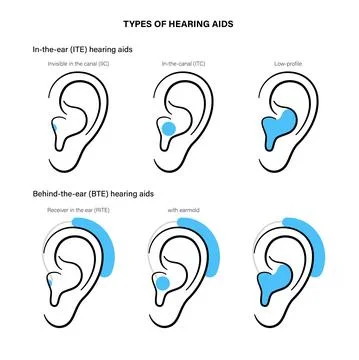 Hearing aids types Illustration