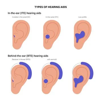 Hearing aids types Illustration