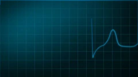 Heart activity line, EKG ECG  Stock Footage 540435