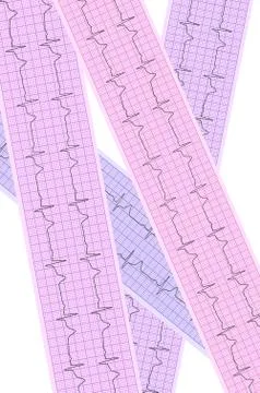 Heart analysis, electrocardiogram graph (ECG) Stock Photos