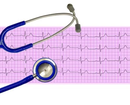 Heart analysis, electrocardiogram graph (ECG) and stethoscope Stock Photos