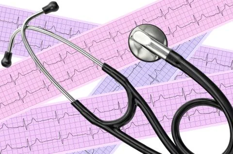 Heart analysis, electrocardiogram graph (ECG) and stethoscope Stockfoto's