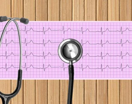 Heart analysis, electrocardiogram graph (ECG) and Stethoscope on wooden table Foto stock