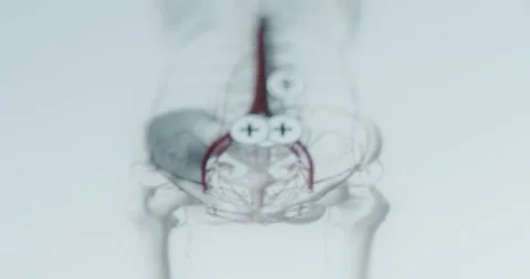 Heart and arteries passing through thorax, abdomen and pelvis Stock Footage 313623847