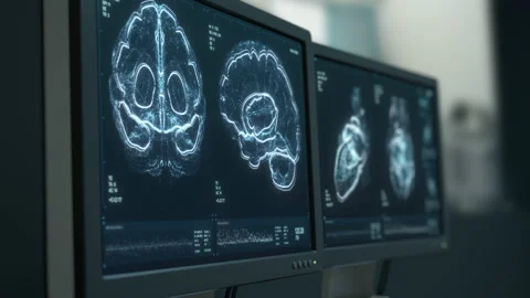Heart and brain scanning data displayed on hospital monitors Stock-Footage 148377599