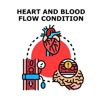 Heart and circulation problems with blood flow condition Stock Illustration