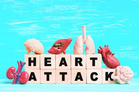 Heart Attack Concept with Letter Blocks and Miniature Organs Stockfoto's