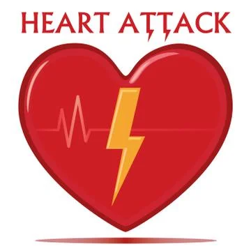 Heart Attack Illustration Vector Stock Illustration