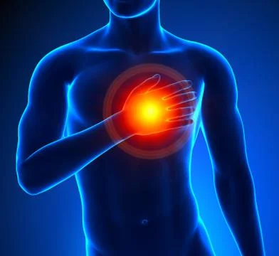 Heart-Attack Male Stock-Illustration