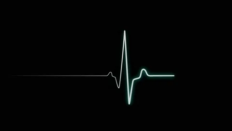 Heart attack or sudden cardiac arrest Stock-Footage 115908759