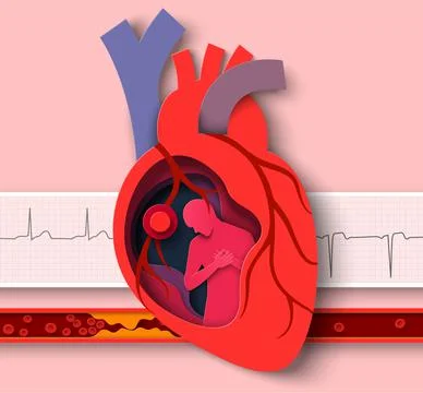 Heart attack paper cut vector cardiology disease Stock-Illustration