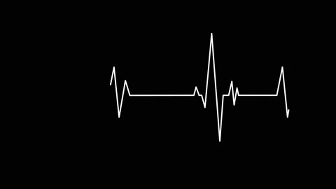 Heart beat cardiogram animation Stockbeeldmateriaal 115279160