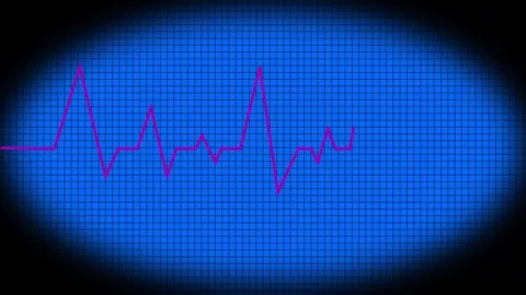 Heart beat line animation on black background. medical concept Abstract glo.. Stock Footage 340179405