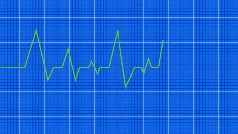 Heart beat line animation on black background. medical concept Abstract glo.. Stock Footage 340595754