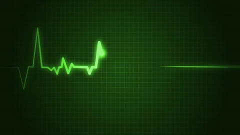 Heart beat line on graph paper showing an ecg pattern and medical signal an.. Stock Footage 336905049