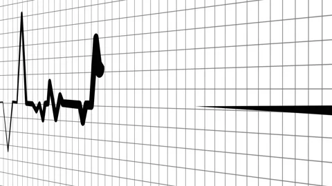 Heart beat line on graph paper showing an ecg pattern and medical signal an.. Stock Footage 336905059