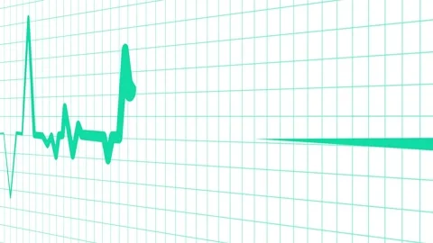 Heart beat line on graph paper showing an ecg pattern and medical signal an.. Stock Footage 336905062