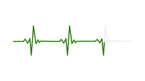 Heart beat line. Self drawing animation ... | Stock Video | Pond5