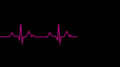 Heart beat line. Self drawing animation with alpha channel. Seamless loop. Stock Footage 292379893