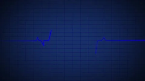 Heart Beat Pulse animated video, medical concept 库存影片 259560470