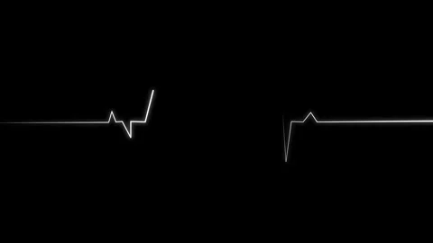 Heart Beat Pulse animated video, medical concept 库存影片 259560473