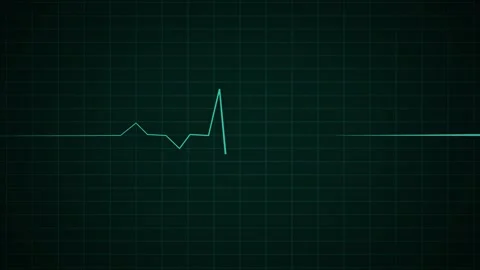 Heart Beat Pulse animated video, medical concept Видео 259560480