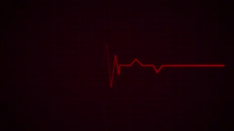 Heart Beat Pulse animated video, medical concept Stockbeeldmateriaal 259560482