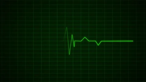 Heart Beat Pulse animated video, medical concept Stock Footage 259560485