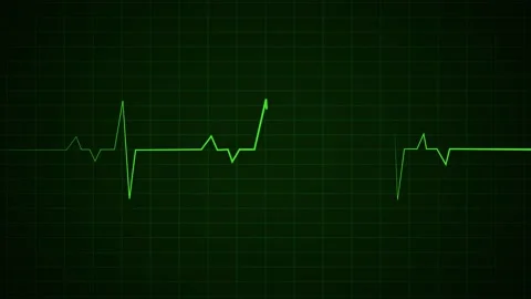 Heart Beat Pulse animated video, medical concept Stockbeeldmateriaal 259560491