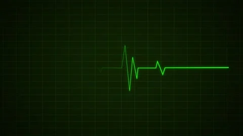 Heart Beat Pulse animated video, medical concept Stock Footage 259560503