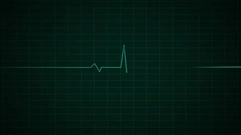 Heart Beat Pulse animated video, medical concept Stock Footage 259560508