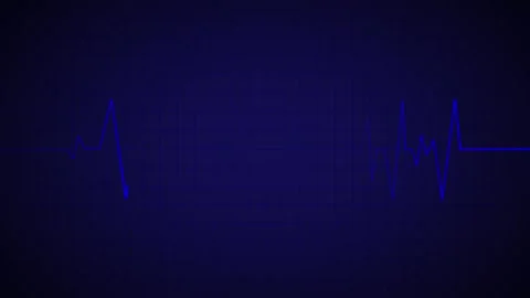 Heart Beat Pulse animated video, medical concept 库存影片 259560613