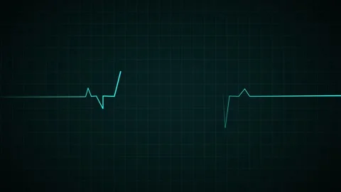 Heart Beat Pulse animated video, medical concept 库存影片 259560622