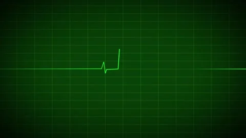 Heart Beat Pulse animated video, medical concept Видео 259615974