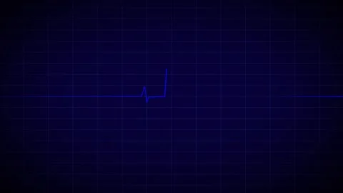 Heart Beat Pulse animated video, medical concept Vídeo Stock 259615975