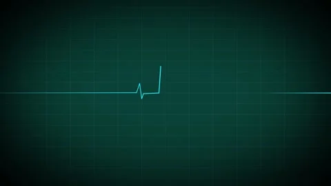 Heart Beat Pulse animated video, medical concept Vidéo 259615976
