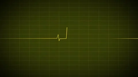 Heart Beat Pulse animated video, medical concept 스톡 동영상 259615978