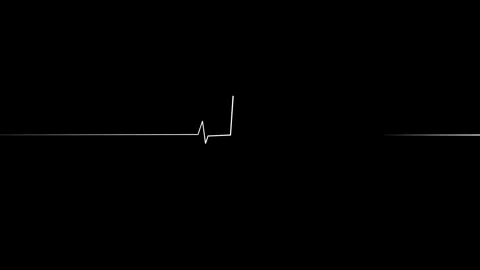 Heart Beat Pulse animated video, medical concept Stock Footage 259615983