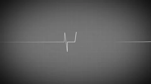 Heart Beat Pulse animated video, medical concept Stock Footage 259615991