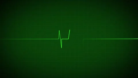 Heart Beat Pulse animated video, medical concept Stock Footage 259615992